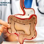 Understanding Treatment Options for Haemorrhoids in Singapore