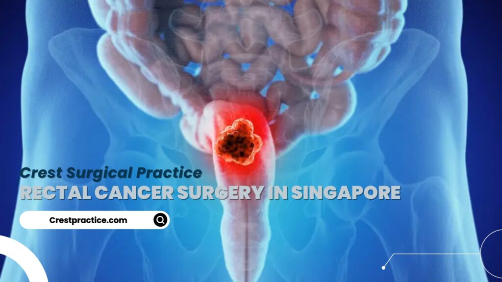 Rectal Cancer Surgery