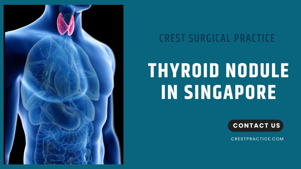 Thyroid Nodule